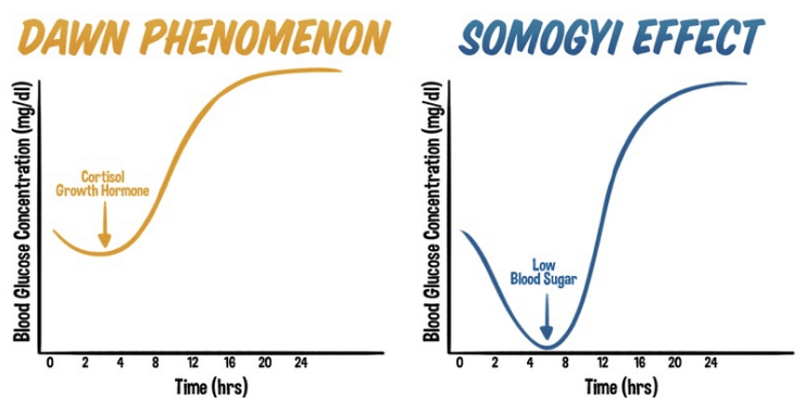 Tabulky hladiny cukru v krvi pro osoby, které zažívají fenomén úsvitu a somogyiho efekt.